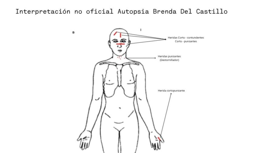 Interpretación no oficial Autopsia Brenda del Castillo