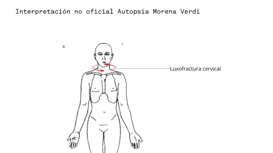 Interpretación no oficial Autopsia Morena Verdi
