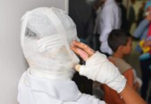 Dos quemados por pólvora en el inicio de diciembre: trabajador recibió una papeleta en el rostro