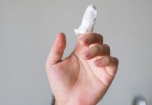 Risaralda cerró fin de año con 25 lesionados por pólvora, incluyendo un menor de 11 años