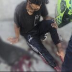 Habitante de calle murió tras romper una ventana en un aparente intento de hurto: una grave herida en su pierna le costó la vida