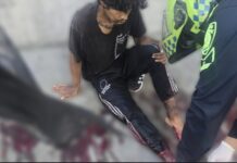 Habitante de calle murió tras romper una ventana en un aparente intento de hurto: una grave herida en su pierna le costó la vida